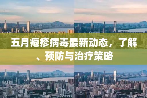 五月疱疹病毒最新动态，了解、预防与治疗策略